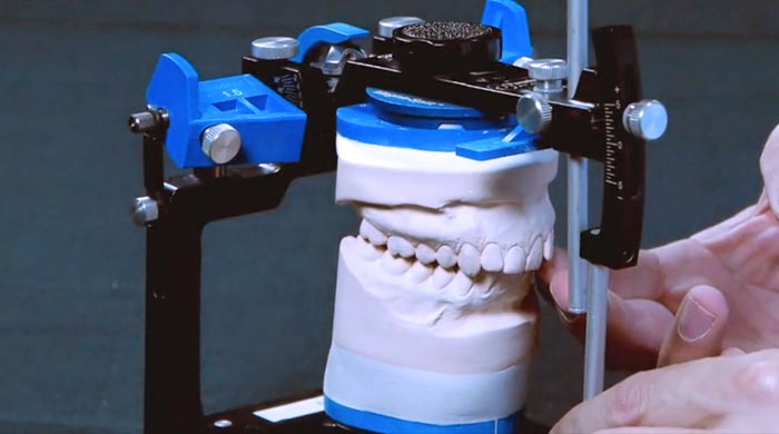 Mounting the Lower Model on the Panadent Articulator | Spear Education
